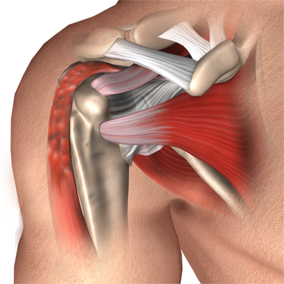 Biceps Tenodesis