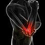 Triceps Tendon Repairs