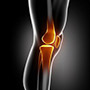 Knee Fractures