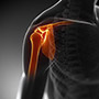 Anatomic Shoulder Joint Replacement