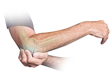 Elbow Stiffness